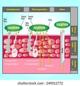 Illustration Of Transdermal Delivery Skin Pore Mechanism. Enhancement Of Skin Penetration