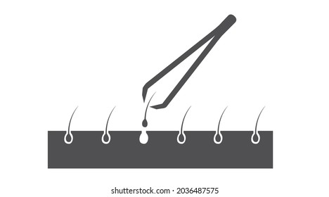 Illustration of tweezers and hair on the skin. Vector isolated editable flat illustration