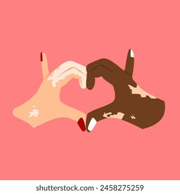 Illustration of two hands forming a heart with both hands suffering from vitiligo isolated on a pink background