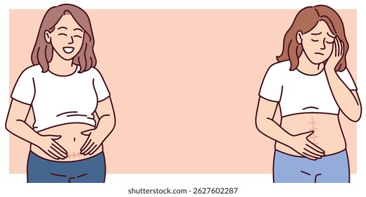 Illustration of two women showing their C-section scars with proud expressions, supporting postpartum body positivity, with extra space for text in the background, copy space