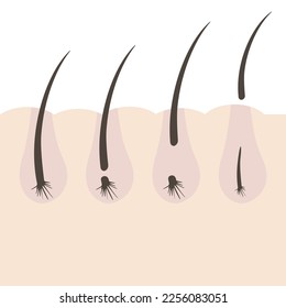 Illustration with type of eyelashes. Phases of growth. Hair growth cycle. Anagen, catagen, telogen, early anagen.