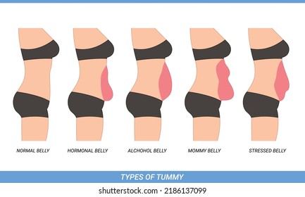 Illustration of Types Of Tummies for woman, body type, health, weight problem