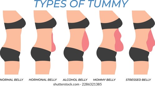 Illustration of Types Of Tummies for woman, body type, health, weight problem