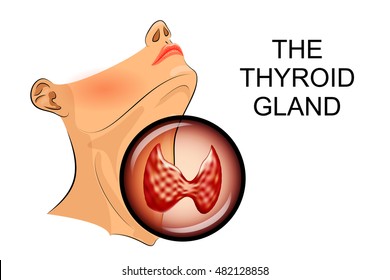 illustration of ultrasound diagnostics of thyroid diseases