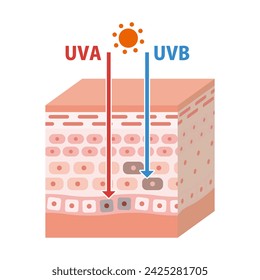 Illustration of ultraviolet rays and skin structure explaining the mechanism of sunburn (3D)