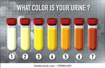 Illustration Urine Color Chart Illustration Stock Vector (Royalty Free ...