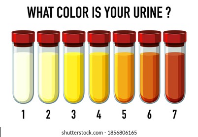 Illustration Of Urine Color Chart Illustration