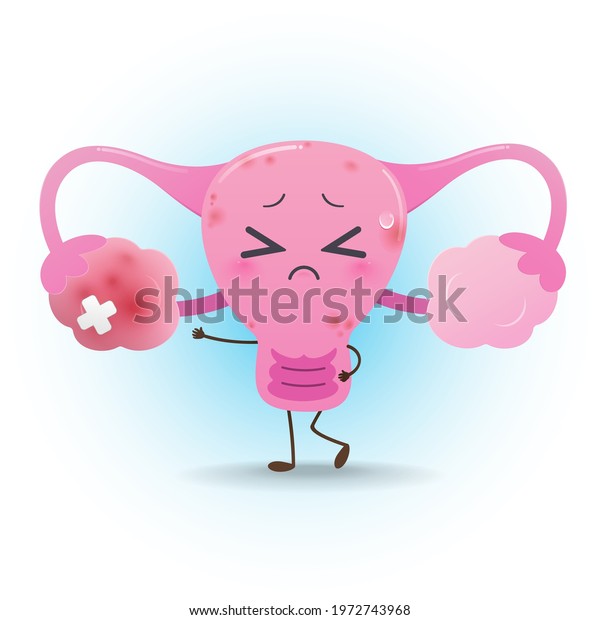 Illustration Uterus Inflamed Ovary Against Blue Stock Vector (Royalty ...