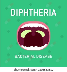 Illustration Vector: Diphteria bacterial disease, medical concept