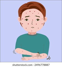 Illustration vector graphic of Young man allergy, scratching body, good for showing sick symptoms, isolated on blue background
