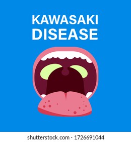 Illustration Vector: Kawasaki Disease, Bacterial Infected Tounge And Mouth