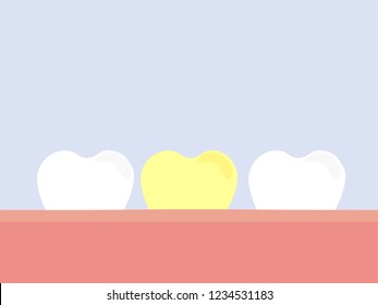 an illustration vector of tooth arrangements based on their colour and infection. good and yellow  tooth. dentistry and medical concept. 