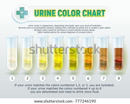 Illustration Visual Poster Urine Color Chart Stock Vector | SexiezPix ...