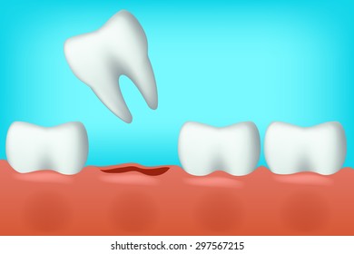 illustration of white teeth on blue background one fell