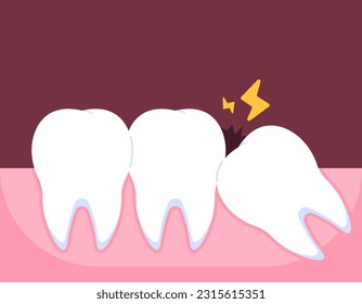 Illustration of a wisdom tooth that is starting to grow. Wisdom teeth grow obliquely. the onset of pain due to tooth impaction. problems and pain. illustration concept design. vector elements