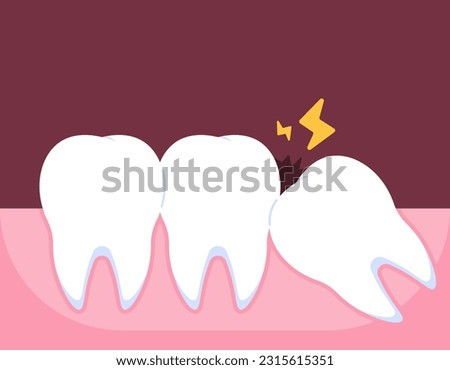 Illustration of a wisdom tooth that is starting to grow. Wisdom teeth grow obliquely. the onset of pain due to tooth impaction. problems and pain. illustration concept design. vector elements