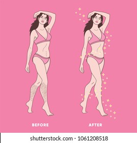 Illustration of woman body hair removal. Before and after concept design