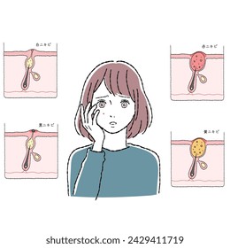 Illustration of a woman concerned about acne and the structure of acne