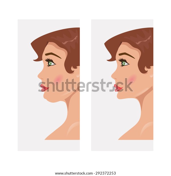 顎が二重で顎が正常な女性のイラスト のベクター画像素材 ロイヤリティフリー
