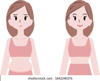 Illustration of a woman with a fat lower abdomen and a woman in controlling undergarment.