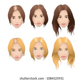 Illustration of woman hair loss. Illustration of blonde and brunette with alopecia