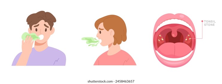 Ilustración de un problema de mal aliento y la anatomía oral de la mujer que muestra la causa del cálculo de la amígdala de la halitosis. Concepto de cuidado de la salud, estilo de vida, higiene oral y dental. Carácter de Vector plano.