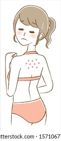 Illustration of a Woman Suffering from Acne on the Back