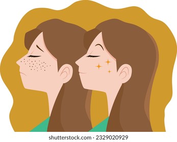 Illustration of a woman suffering from freckles on her face