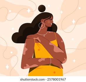 Illustration of a woman with vitiligo wearing a yellow dress, smiling confidently. Abstract background with flowing lines and sparkles. Empowerment concept. Vector illustration.