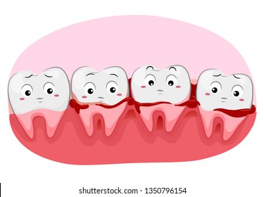 Illustration of Worried Teeth Mascots with Bleeding Gums