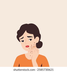 Illustration of a worried woman with acne on her face, touching her cheek. Concept of skin problems, dermatology, acne treatment, and skincare in a modern flat design style