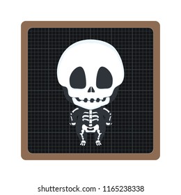 Illustration of an x-ray scan