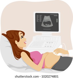 Illustration of a Young Pregnant Girl Having Her Ultrasound