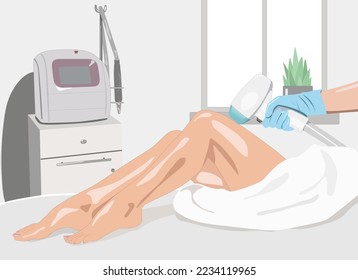 Ilustración.Elos epilación, procedimiento de depilación en el cuerpo de una mujer. Beautician haciendo rejuvenecimiento láser en un salón de belleza. Eliminando el pelo corporal no deseado. 