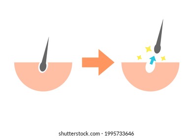 Illustrations about hair loss. Vector illustration.