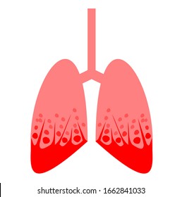 Illustrationen und Grafiken der Bronchien und Lungen einzeln auf weißem Hintergrund, Beschädigte und blutende menschliche innere Organe, Gefahren von Covid-19 und anderen Grippeviren