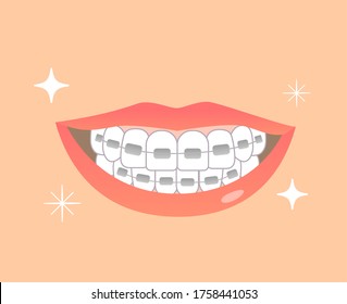 illustrations of orthodontics beautiful tooth 