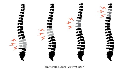 Illustrations of spine icons with highlighted areas indicating back pain. Medical symbols for spine health and injury.