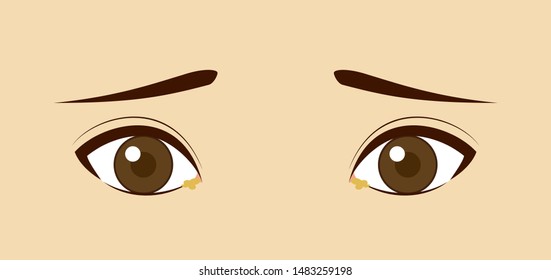 Illustrations troubled by eye grease