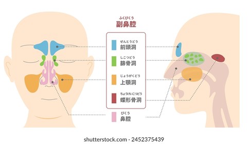 Illustrative illustrations of the anatomy of the paranasal sinuses from frontal and lateral sagittal plane views [TRANSLATE];Paranasal sinus ,Frontal sinus ,Ethmoid sinus ,Sphenoid sinus 