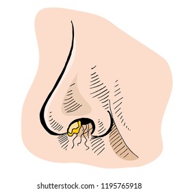 An image of a Crusty Boogers Hairy Nostril Nose.