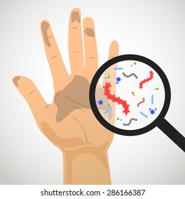 Image of dirty hand and the germs in the magnifying glass to enlarge.