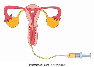 Imagen del sistema reproductivo interno y femenino