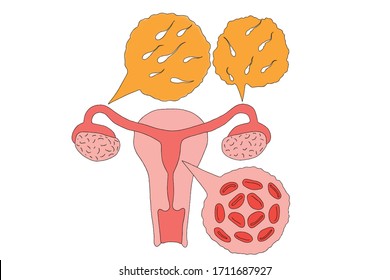 Image of female uterus and sperm