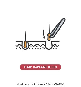 Image of hair graft. Schematic drawing of the procedure of a hair implant. Line icon.
