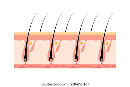 Image of hair removal, before and untreated hair