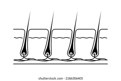 Image of hair removal, before and untreated hair