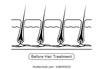 Image of hair removal, before and untreated hair