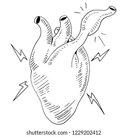 An image of a Heart Organ Attack Clogged Artery.