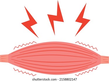 Bild-Illustration von Muskelschmerzen